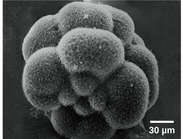 Sea urchin embryo when it has divided into 16 conjoined cells