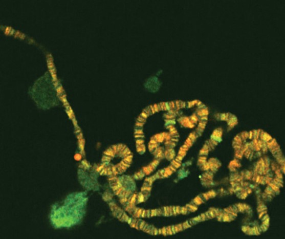 Electron micrograph shows a long, thin chromosome that has a banding pattern