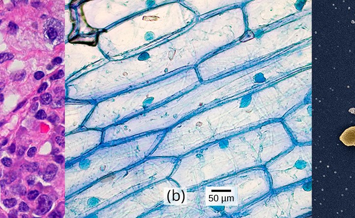 Cells under a microscope