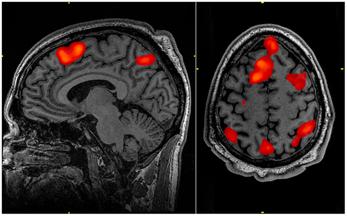 FMRI scan during working memory tasks.